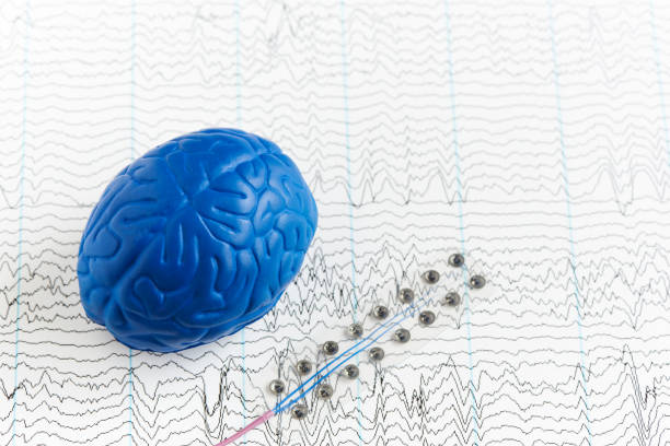 brain waves recording electrodes and brain model - eeg epilepsy science electrode imagens e fotografias de stock