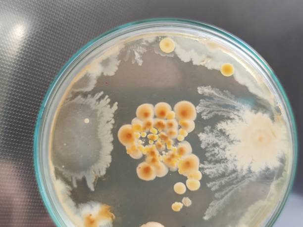 istock Bacterial and fungal colonies on Sabouraud dextrose agar medium 1207062693