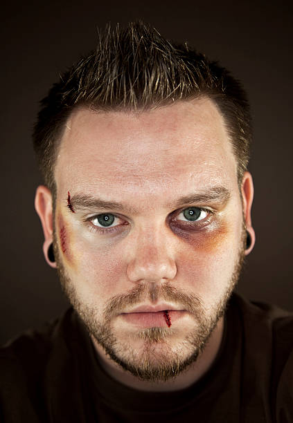 istock Male domestic violence victim 120720289