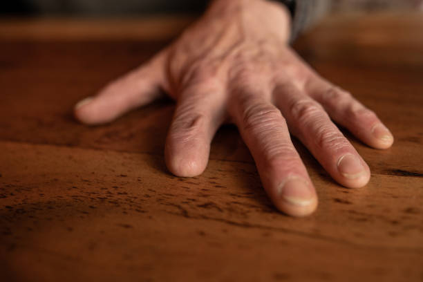 istock The amputated hand of a carpenter 1207256228