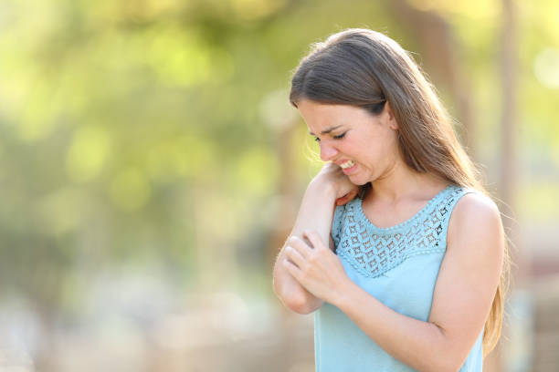istock Woman scratching because her arm itches in a park 1207374544
