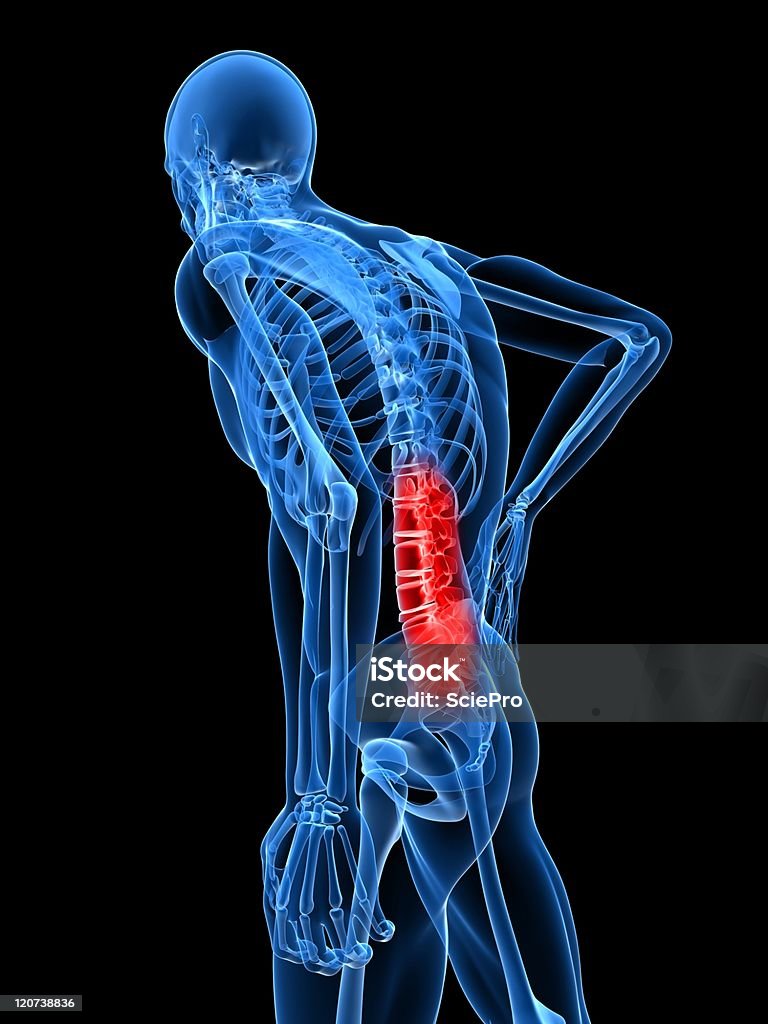 backache illustration Anatomy Stock Photo