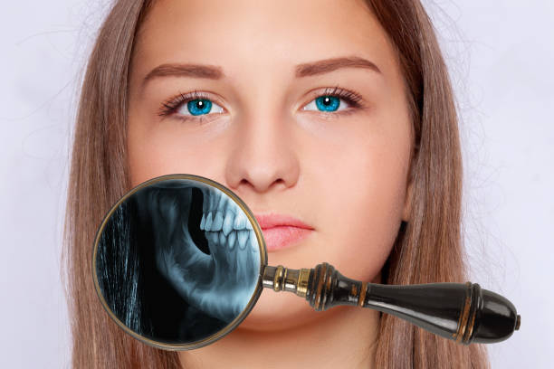 istock X-ray with a magnifying glass from the visual field of a person's jaw 1207525887