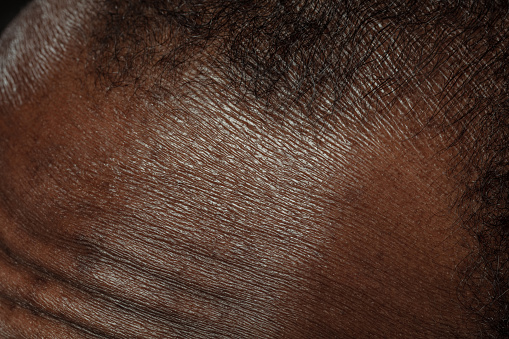 Head, face. Detailed texture of human skin. Close up shot of young african-american male body. Skincare, bodycare, healthcare, hygiene and medicine concept. Looks beauty and well-kept. Dermatology.