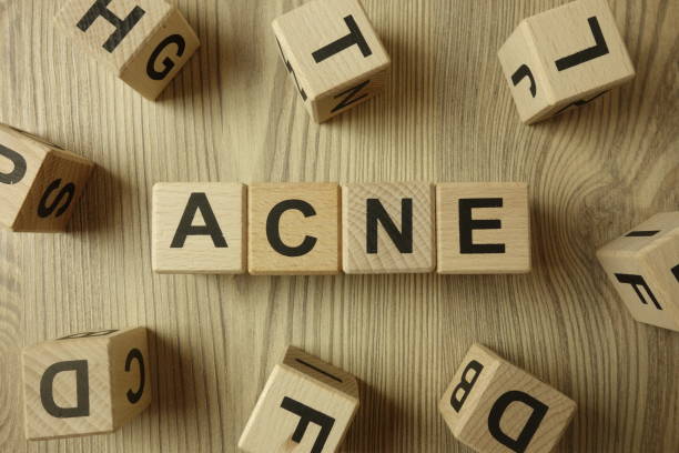 istock Word acne from wooden blocks 1207785035