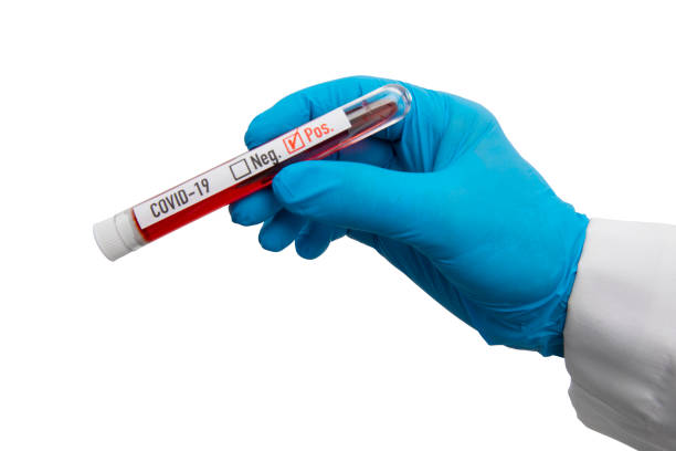 blue gloved hand holding coronavirus brote de sangre - test tube isolated nobody empty fotografías e imágenes de stock