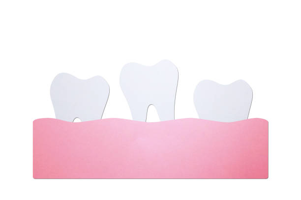 loose tooth or missing teeth, tooth is fall out of the gum - dental cartoon paper cut style cute character for design