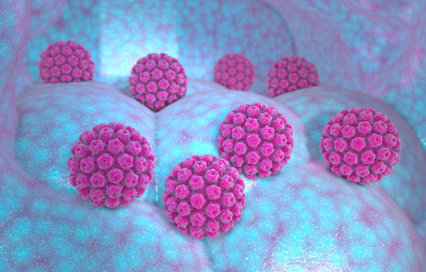 Human papillomavirus infection. Virus. HPV is the most common sexually transmitted infection globally stock photo