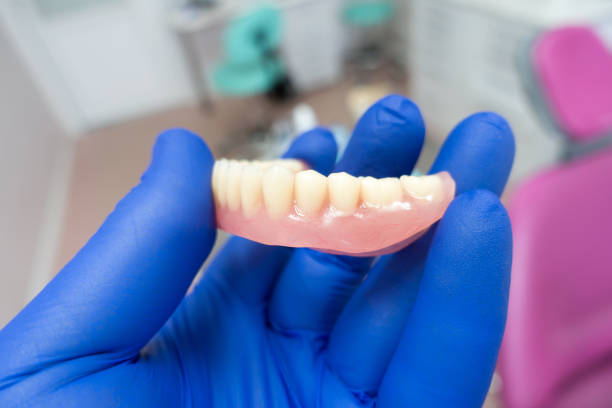 istock removable denture in the hands of a doctor 1207990603