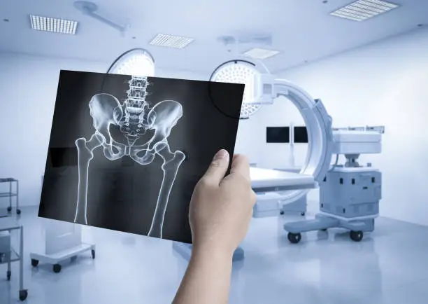 Photo of X-ray film diagnosis