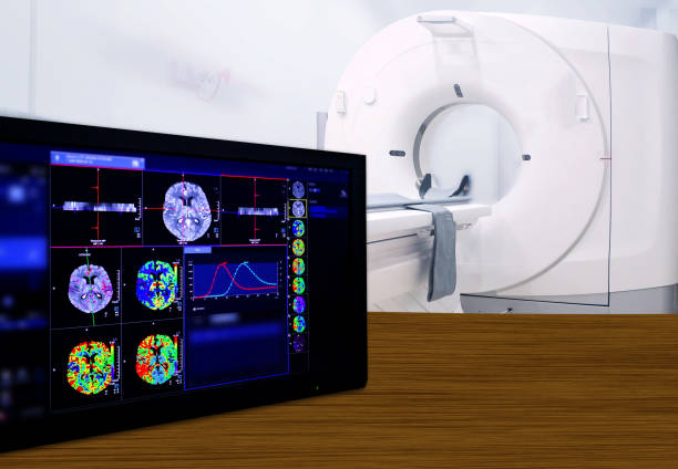 istock Brain Perfusion or CT scan of Blood flow in the brain 3d rendering image on the screen 1208084929