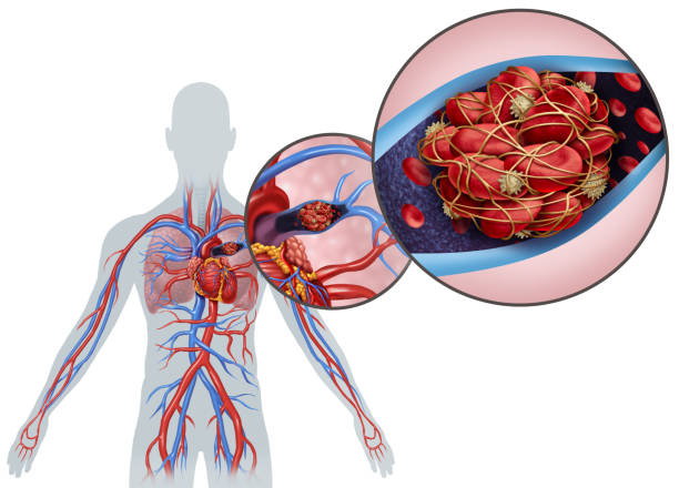 анатомия легочной эмболии - thrombus стоковые фото и изображения