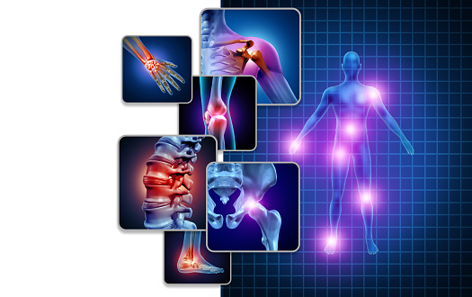Joint body pain concept as skeleton and muscle anatomy of the body with a group of sore joints as a painful injury or arthritis illness symbol for health care and medical symptoms with 3D illustration elements.