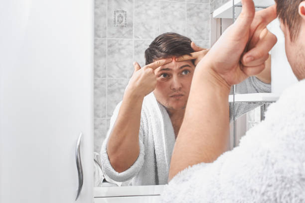 istock a man in a white coat squeezes acne on his face through a mirror in the bathroom. 1208328451