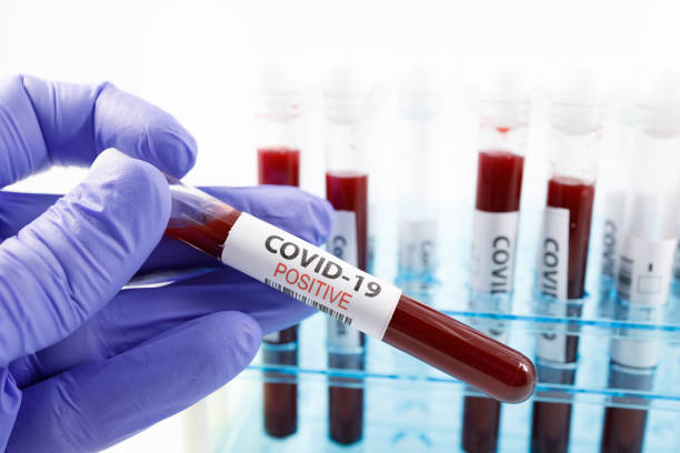 コロナウイルスの陽性血液検査結果を保持する外科用手袋で微生物学者の手をクローズアップ。コピースペースを持つ白い背景に、コビッド-19ウイルスのための血液サンプルを備えた試験管� - close up ストックフォトと画像