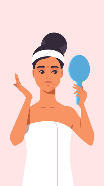 nieszczęśliwa kobieta z problemem trądziku patrząc w lustro ubrany w ręcznik dziewczyna twarzy leczenie koncepcji portret - clear sky human skin towel spa treatment stock illustrations