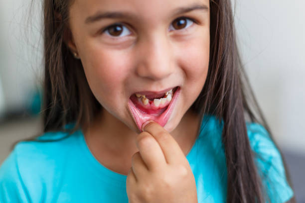 istock Little girl first tooth missing on a white background 1208406249