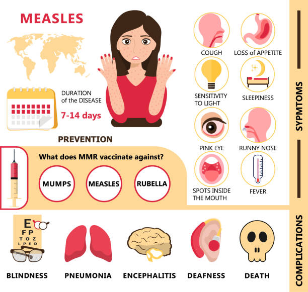 Measles infographic concept vector. Infected human with papules on the skin. Rubeola symptoms and complications illustration. Measles infographic concept vector. Infected human with papules on the skin. Rubeola symptoms and complications illustration. Agitation of vaccination and prevention of measles for medical website. measles illustrations stock illustrations