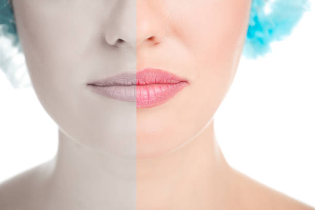 Before and after lip filler injections. Lip augmentation procedure, Beautiful Perfect Lips. Sexy Mouth close up. Beauty young woman Lips Before and after lip filler injections. Lip augmentation procedure, Beautiful Perfect Lips. Sexy Mouth close up. Beauty young woman Lips. Close up over white background. Fillers big fat lips stock pictures, royalty-free photos & images