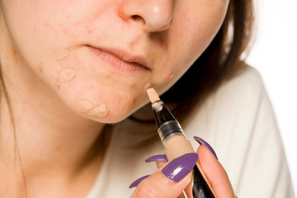 istock Young woman applying concealer on her face on white background 1208532527