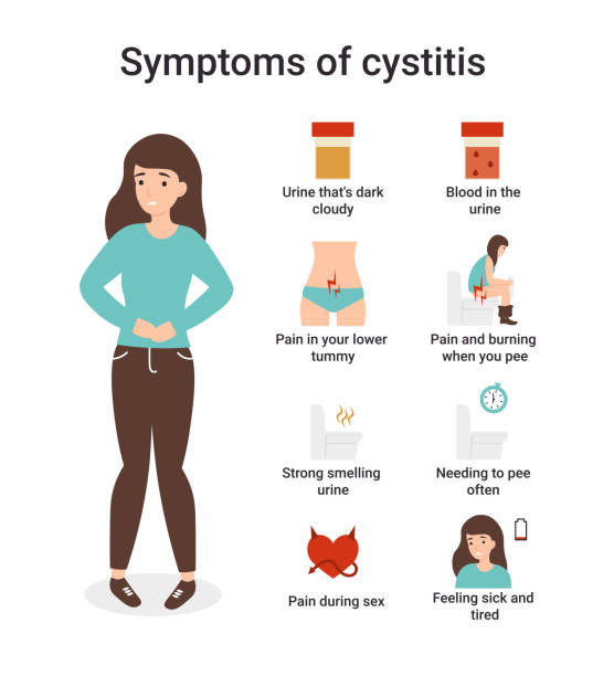set symptoms of cystitis Urinary Tract Infections or cystitis. Set symptoms of cystitis. Flat vector cartoon character isolated white background. urinary tract infection stock illustrations