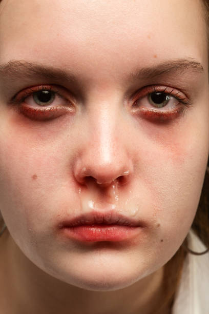 istock face of a cold girl 1208673100