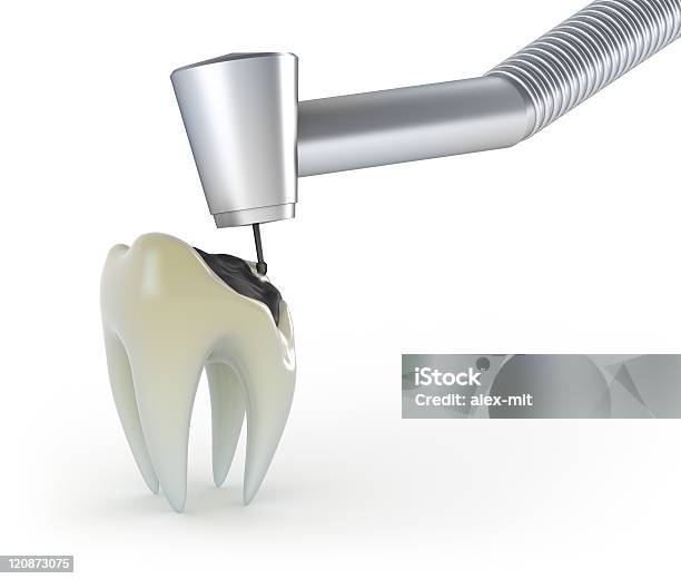 Trattamento Di Un Dente Con Riportata - Fotografie stock e altre immagini di Bianco - Bianco, Composizione orizzontale, Denti umani