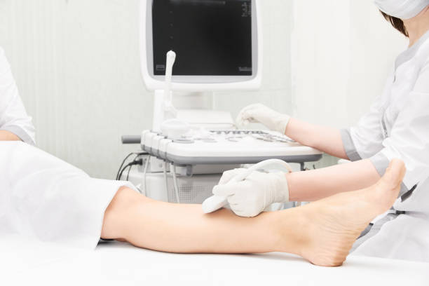 의사 초음파 무릎 검사. 의료 장비를 스캔합니다. 진단 초음파 발. 정맥류 발목 시험 도구 - 정맥 뉴스 사진 이미지