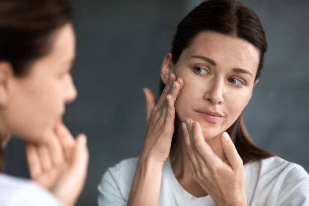 Close up unhappy woman looking at acne spots in mirror Close up unhappy sad woman looking at red acne spots on chin in mirror, upset young female dissatisfied by unhealthy skin, touching, checking dry irritated face skin, skincare and treatment concept pimple photos stock pictures, royalty-free photos & images