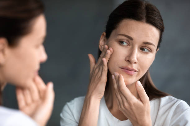 Close up unhappy woman looking at acne spots in mirror Close up unhappy sad woman looking at red acne spots on chin in mirror, upset young female dissatisfied by unhealthy skin, touching, checking dry irritated face skin, skincare and treatment concept looking in mirror stock pictures, royalty-free photos & images