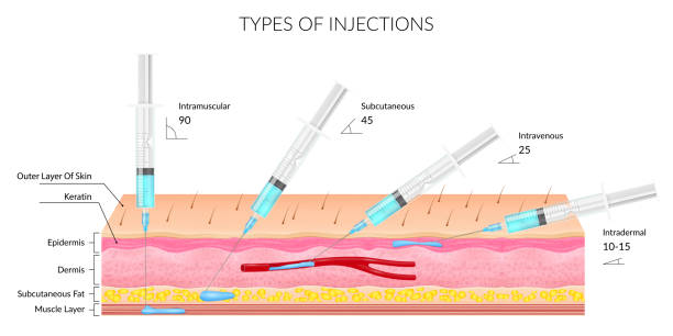 Types of different injections on a white background with the image of the structure of the skin and subcutaneous layers. Realistic vector illustration on a medical theme Types of different injections on a white background with the image of the structure of the skin and subcutaneous layers. Realistic vector illustration on a medical theme skin exame stock illustrations