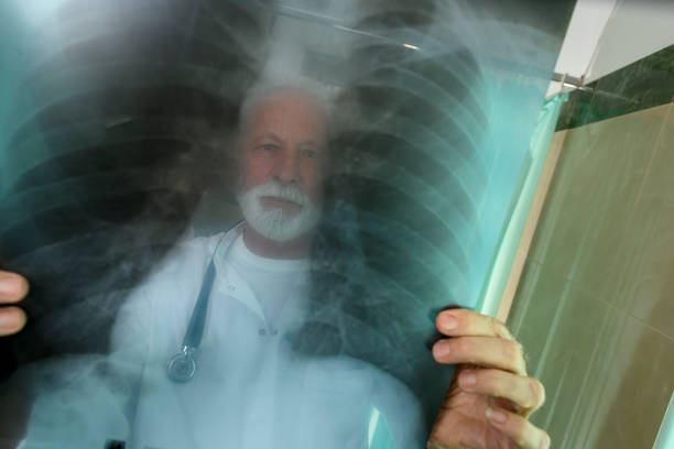 istock A doctor seen through an x-ray image he's holding up 1209209602