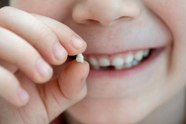 istock Cute Boy Smiling And Showing His First Lost Milk Tooth 1209220243
