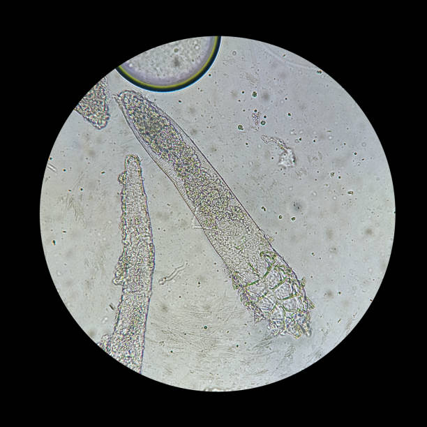 istock Demodex mite from a microscope view. The parasite causing a skin disease -Demodecosis. 1209271224