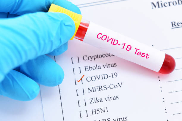 istock Test tube with blood sample for COVID-19 test 1209275440