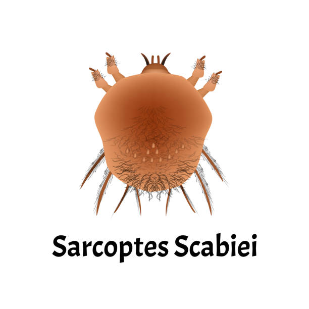 Sarcoptes scabiei. scabies. Sexually transmitted disease. Infographics. Vector illustration on isolated background. Sarcoptes scabiei. scabies. Sexually transmitted disease. Infographics. Vector illustration on isolated background sarcoptes scabiei stock illustrations