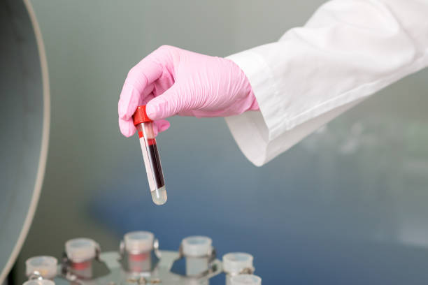 istock Hand with blood test tube. 1209346614