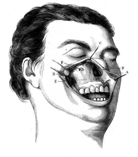 Anterior surface of the maxilla, discovered by the simple upper lip incision in the old book D'Anatomie Chirurgicale, by B. Anger, 1869, Paris Anterior surface of the maxilla, discovered by the simple upper lip incision in the old book D'Anatomie Chirurgicale, by B. Anger, 1869, Paris anatomie stock illustrations