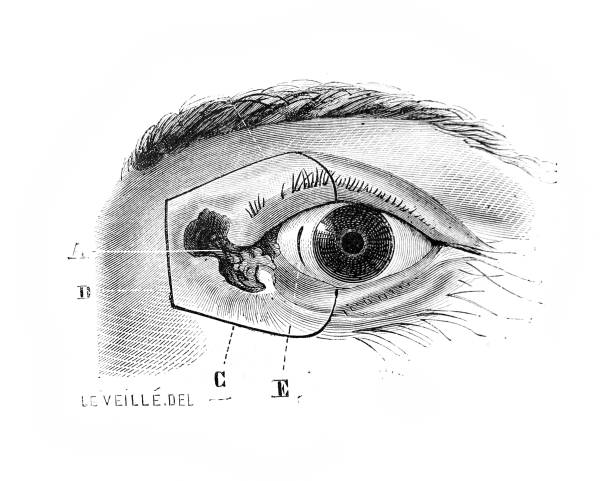 istock Eye cancer in the old book Surgical Anatomy, by B. Anger, 1869, Paris 1209402549