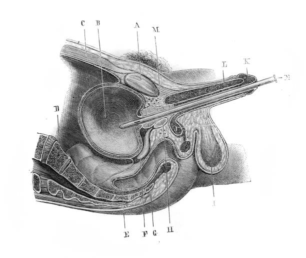 Section of the genitals and urethra during rectilinear catheterization in the old book D'Anatomie Chirurgicale, by B. Anger, 1869, Paris Section of the genitals and urethra during rectilinear catheterization in the old book D'Anatomie Chirurgicale, by B. Anger, 1869, Paris anatomie stock illustrations