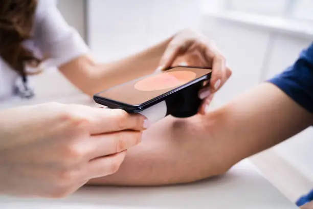 Female Doctor Examining Pigmented Skin Of Male Patient