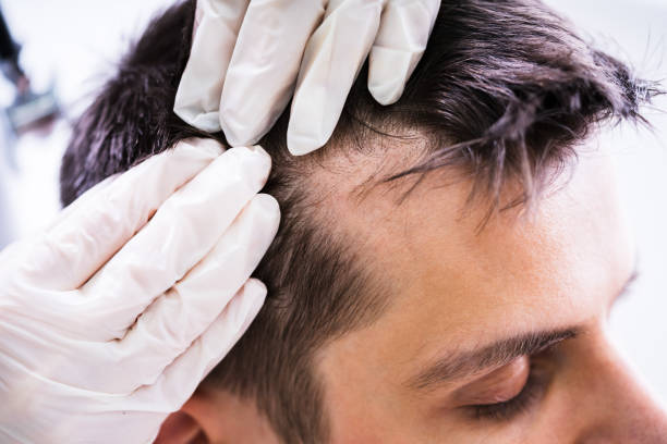 dermatologo che controlla i capelli del paziente - loose hair foto e immagini stock