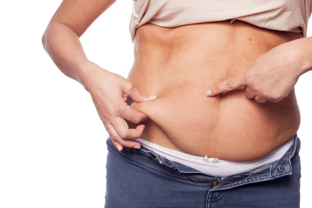 istock High abdominal obesity in a woman aged 40 years 1209495961