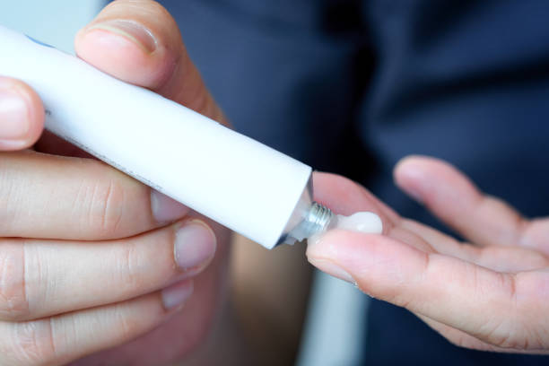 istock The woman's hand, she uses steroids Apply External type 1209577745