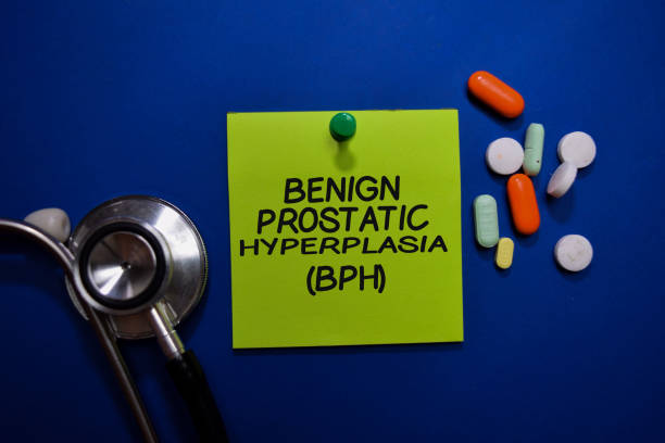 istock Benign Prostatic Hyperplasia (BPH) write on sticky note isolated on Office Desk. Healthcare or Medical Concept 1209652722