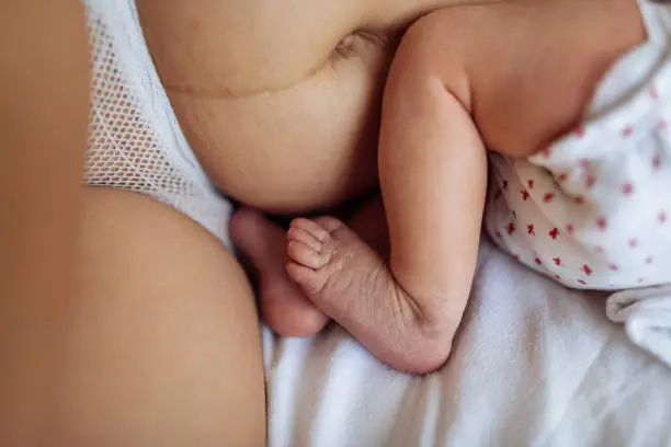 Millennial mother with visible postpartum body marks in bed with baby