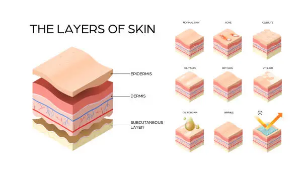 Vector illustration of set different types skin layers cross-section of human skin structure skincare medical concept flat horizontal