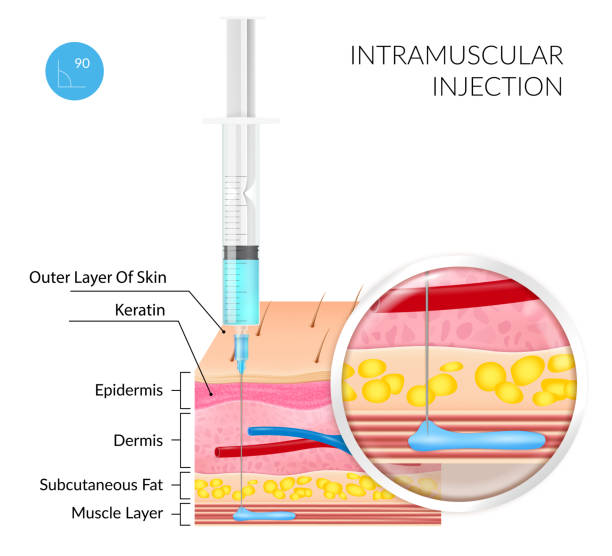 Realistic image of Intramuscular injection on a white background with the image of the structure of the skin and subcutaneous layers. Vector illustration on a medical theme Realistic image of Intramuscular injection on a white background with the image of the structure of the skin and subcutaneous layers. Vector illustration on a medical theme medical injection stock illustrations