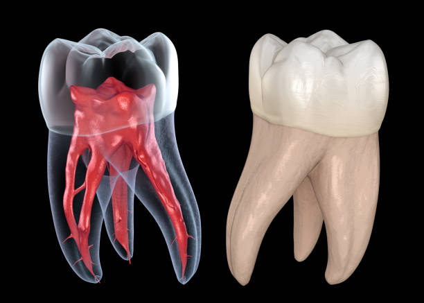 Dental root anatomy - First maxillary molar tooth. Medically accurate dental 3D illustration Dental root anatomy - First maxillary molar tooth. Medically accurate dental 3D illustration cusp stock pictures, royalty-free photos & images