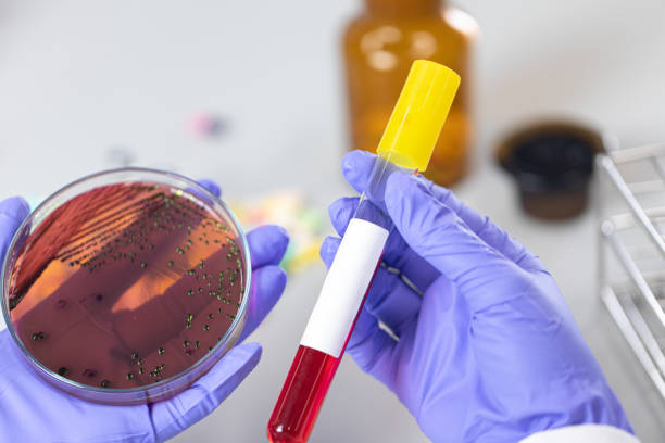 istock Analysis and study vaccine of Coronaviruses disease (CoV) in the laboratory. 1209887953